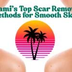 scar removal
