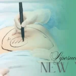 liposuction new york