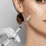 dermal fillers